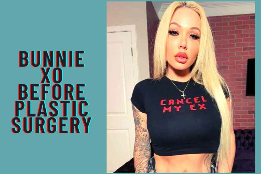 Bunnie Xo Before Plastic Surgery