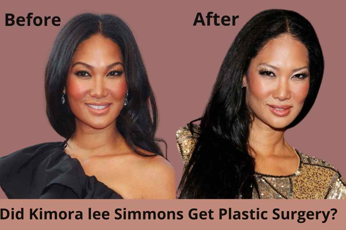 Did Kimora lee Simmons Get Plastic Surgery