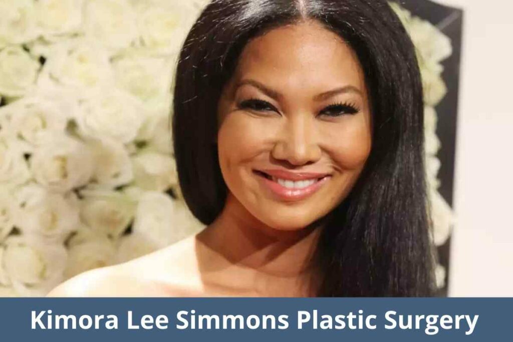 Kimora Lee Simmons Plastic Surgery