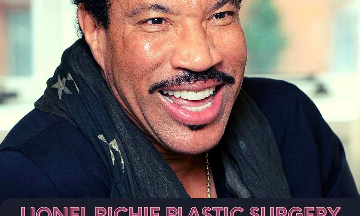 Lionel Richie Plastic Surgery