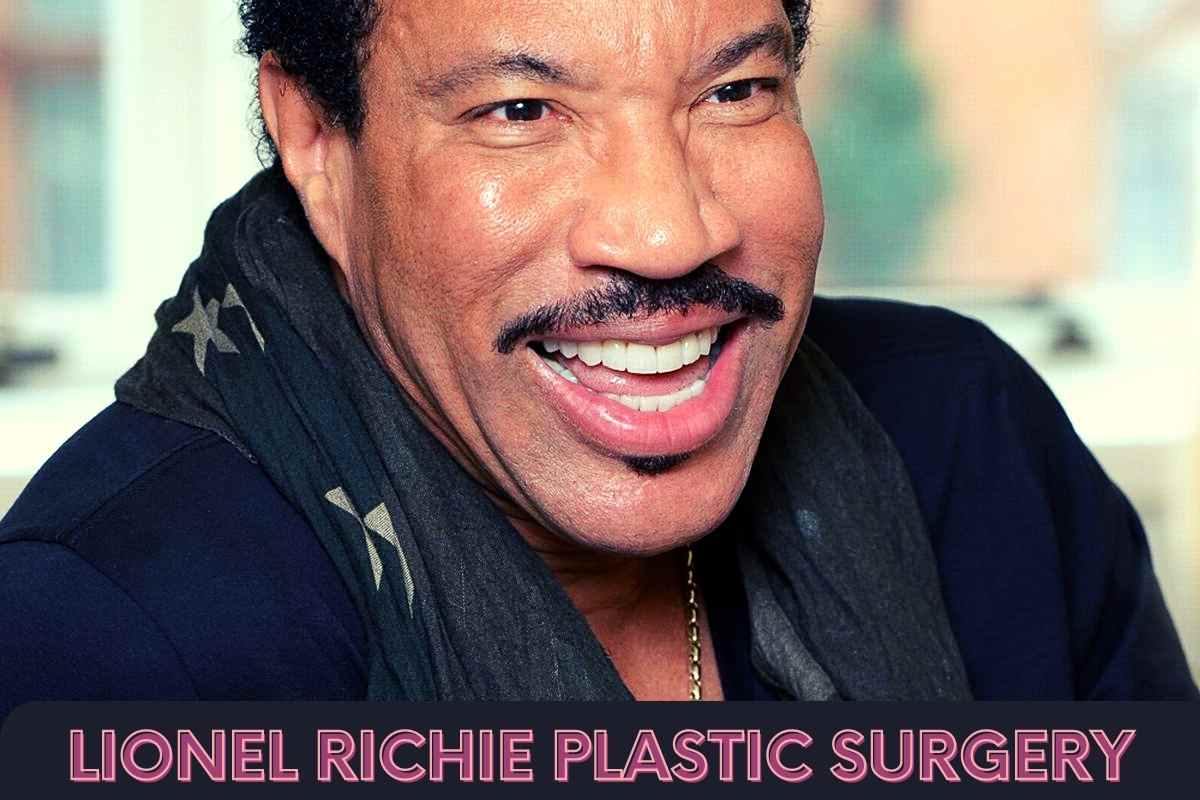 Lionel Richie Plastic Surgery Before And After Botox Facelift 