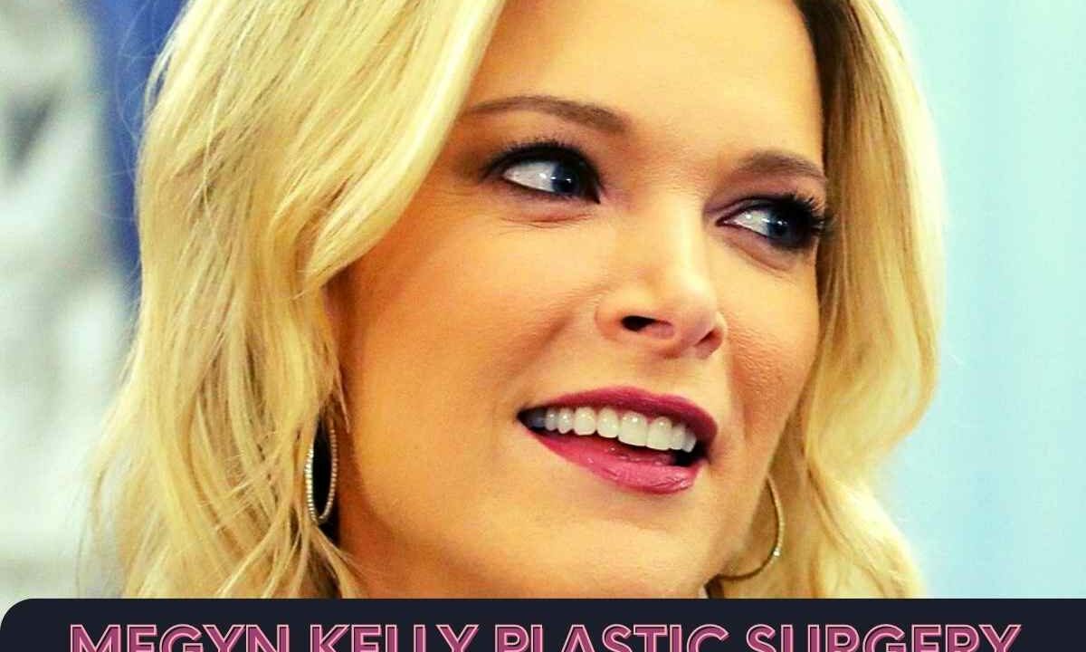 Megyn Kelly Plastic Surgery