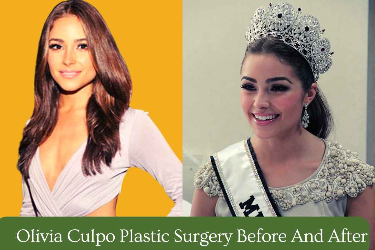 Olivia Culpo Plastic Surgery Before And After