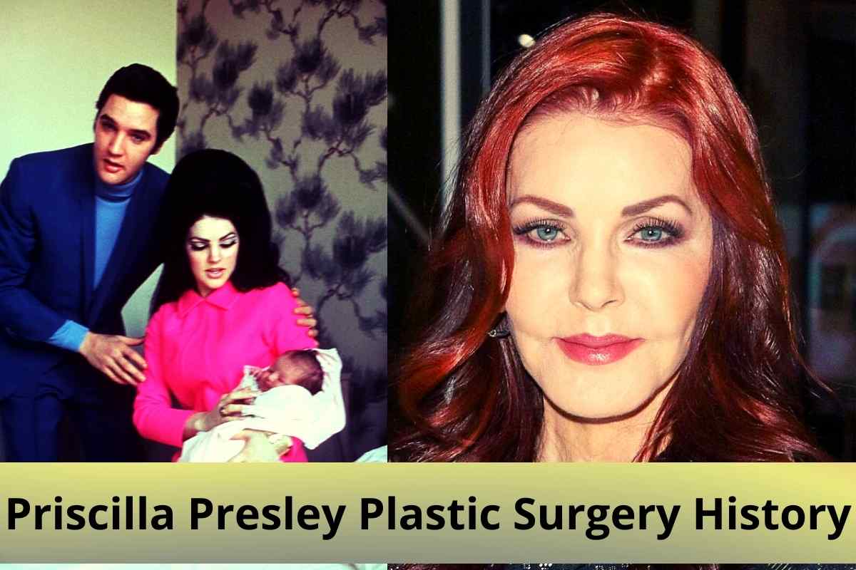 Priscilla Presley Plastic Surgery History
