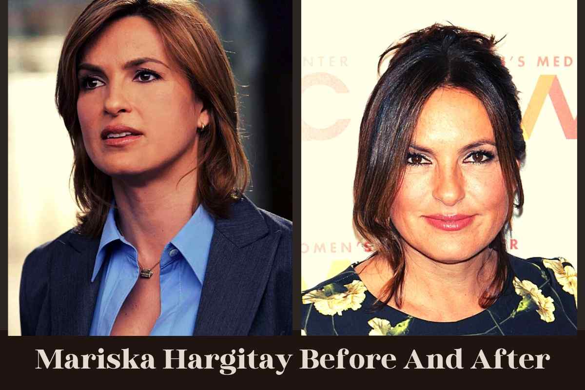 Mariska Hargitay Before And After
