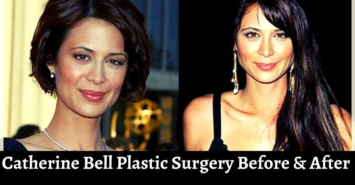 Catherine Bell Plastic Surgery Before & After