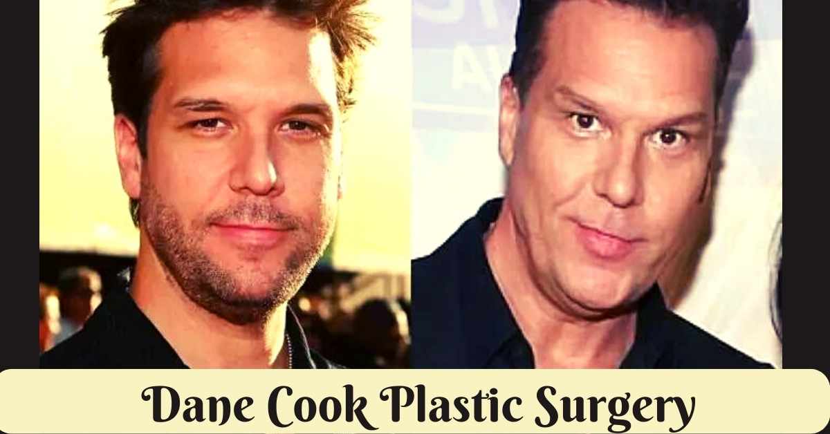 Dane Cook Plastic Surgery
