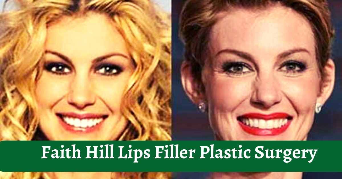 Faith Hill Lips Filler Plastic Surgery