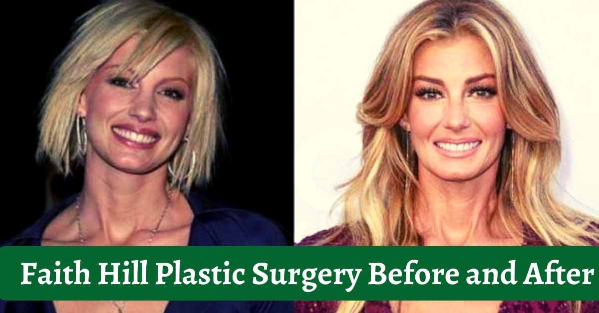 Faith Hill Plastic Surgery Before and After