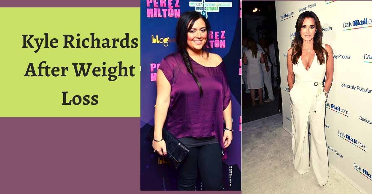 Kyle Richards After Weight Loss