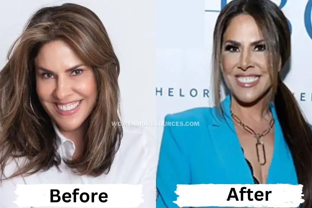 Jennifer Fessler Plastic Surgery: Transformation Before and After