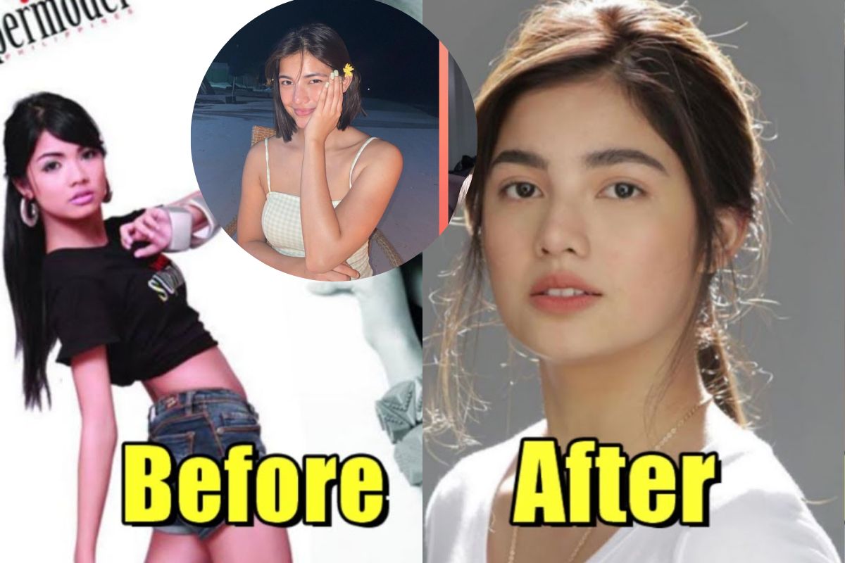 Jane De Leon Before and After: Plastic Surgery Transformation