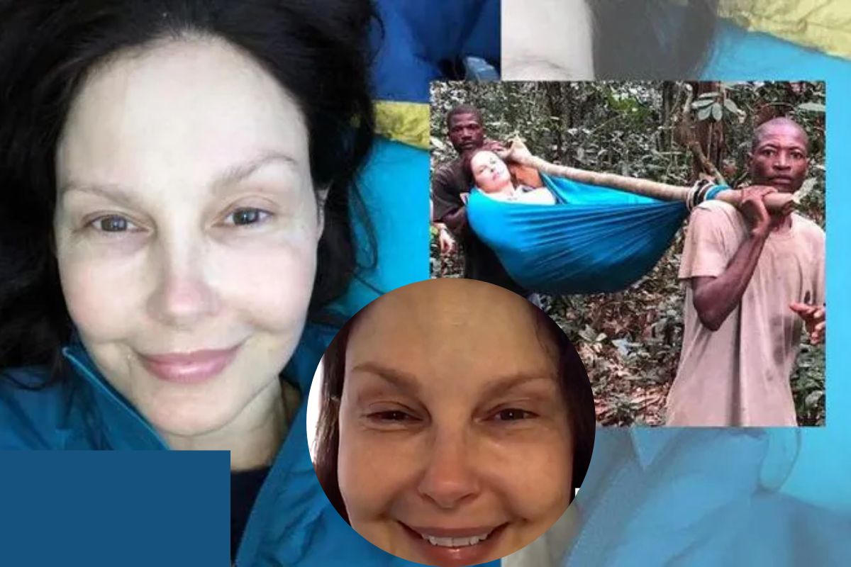 Ashley Judd Face Accident: All You Need to Know!