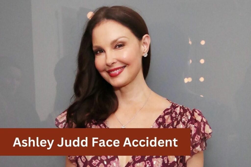 Ashley Judd Face Accident All You Need to Know!