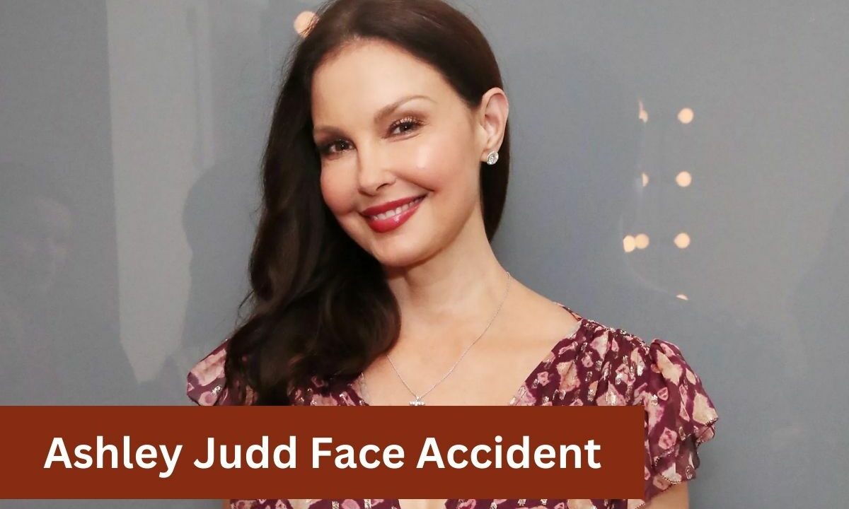 Ashley Judd Face Accident All You Need to Know!