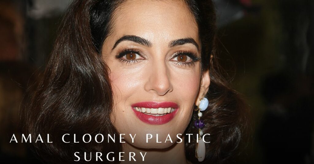 Amal Clooney Plastic Surgery