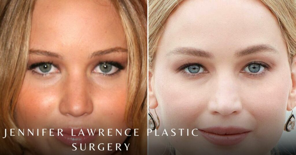 Jennifer Lawrence Plastic Surgery