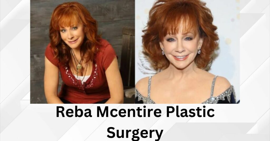 Reba Mcentire Plastic Surgery