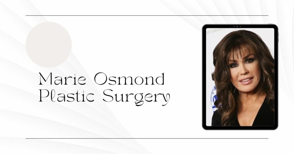 Marie Osmond Plastic Surgery